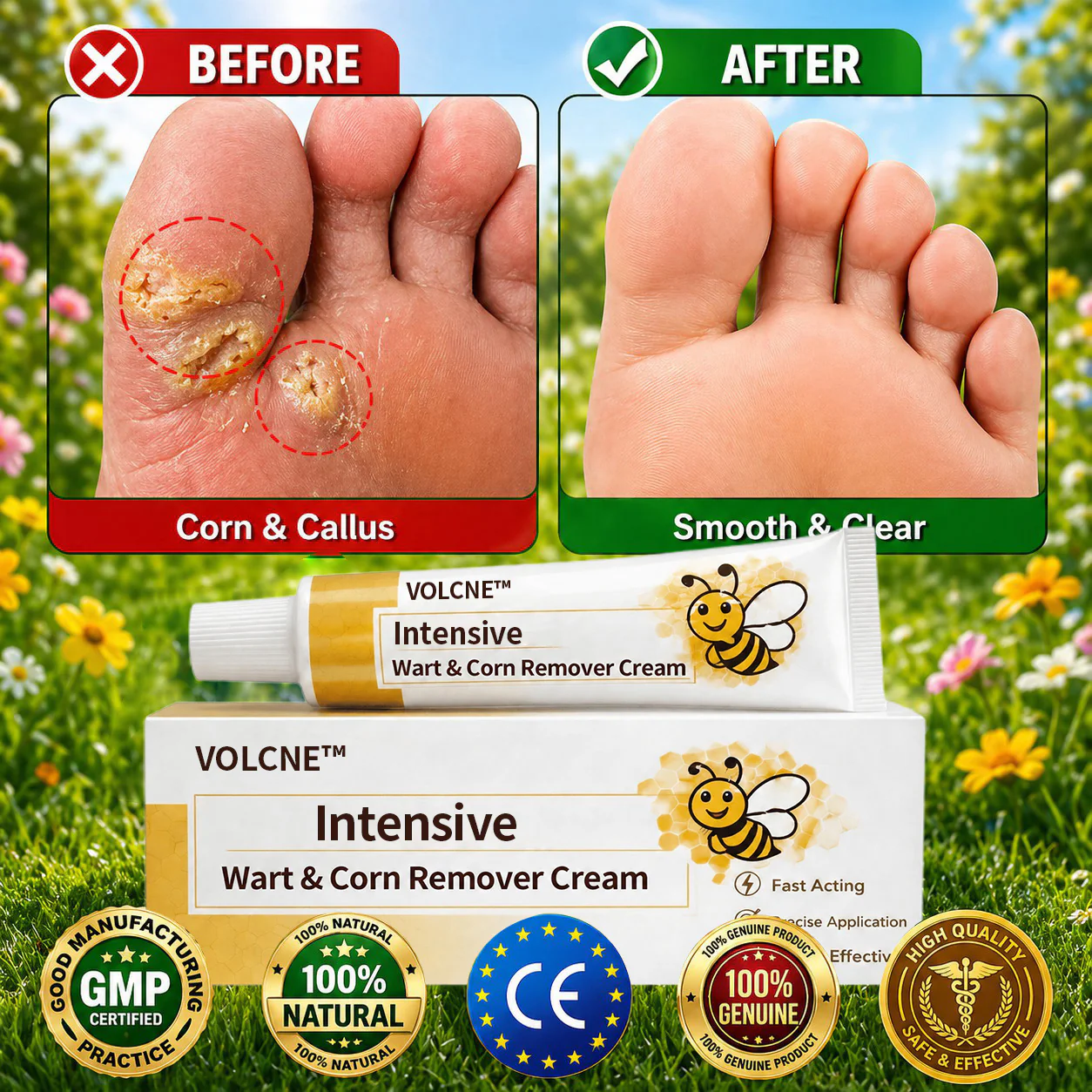 VOLCNE™ Intensive Wart & Corn Remover Cream