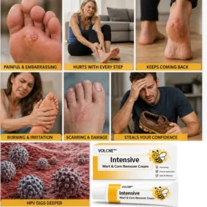 VOLCNE™ Intensive Wart & Corn Remover Cream - Image 6