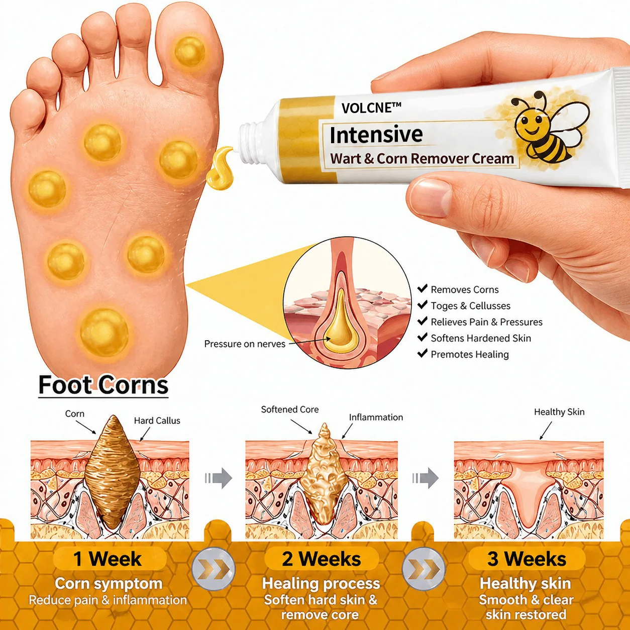 VOLCNE™ Intensive Wart & Corn Remover Cream - Image 5