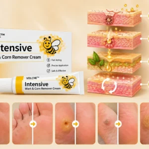 VOLCNE™ Intensive Wart & Corn Remover Cream - Image 4