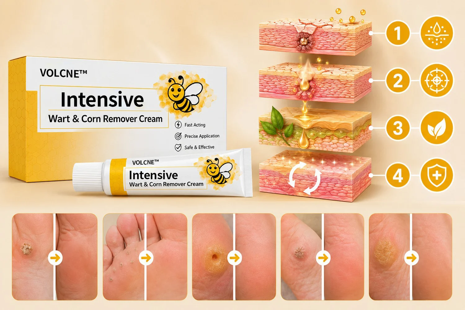 VOLCNE™ Intensive Wart & Corn Remover Cream - Image 4