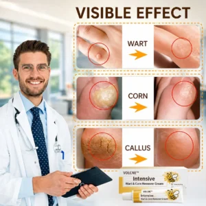 VOLCNE™ Intensive Wart & Corn Remover Cream - Image 3