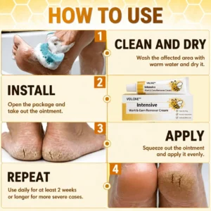 Alternative view of VOLCNE™ Intensive Wart & Corn Remover Cream
