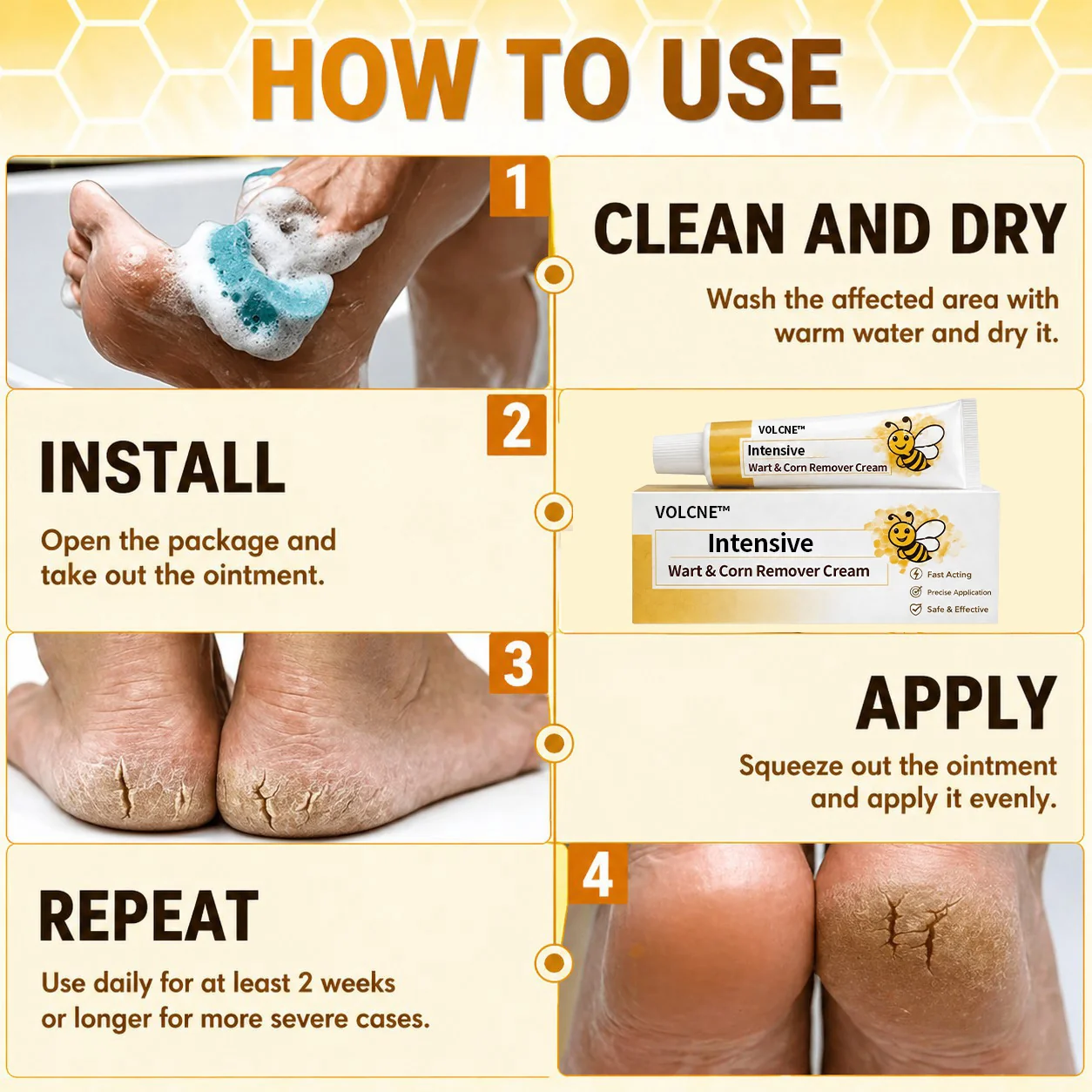 VOLCNE™ Intensive Wart & Corn Remover Cream - Image 2